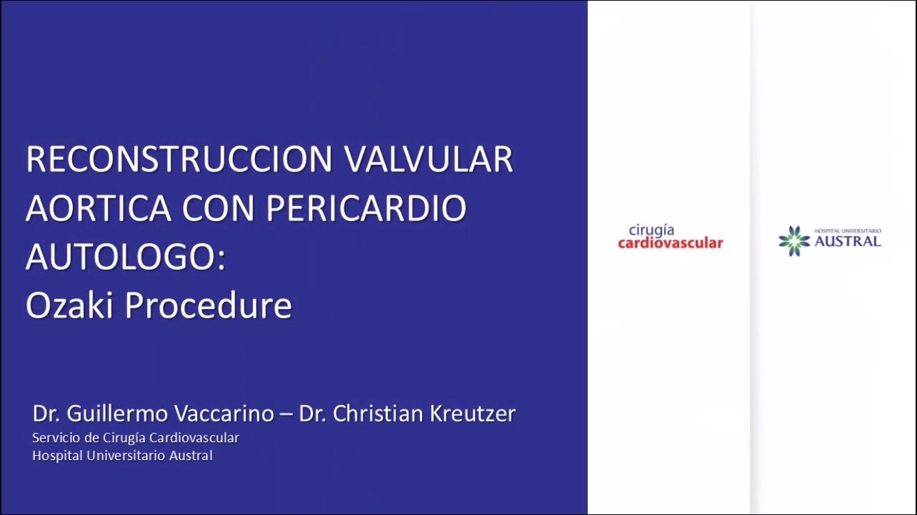 Reconstrucción Valvular Aórtica con Pericardio Autólogo: Procedimiento de Ozaki