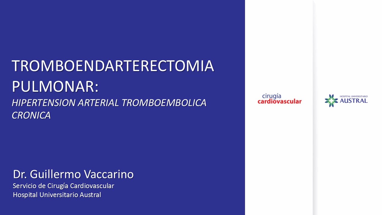 Tromboendarterectomía Pulmonar: Hipertensión Arterial Tromboembólica Crónica