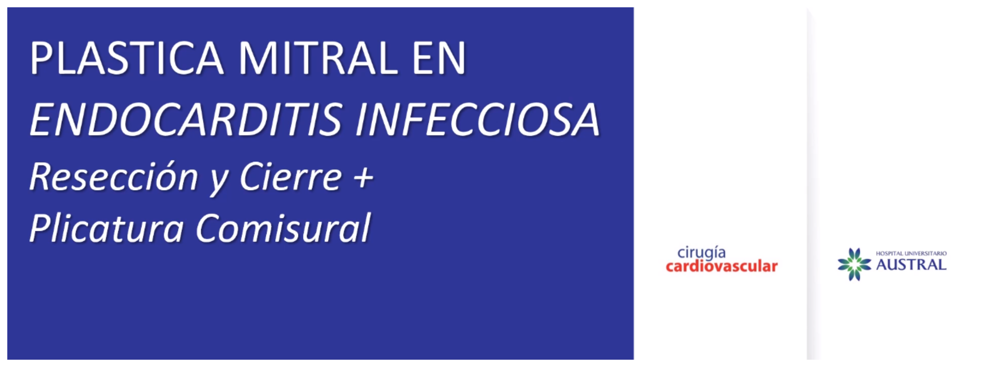 PLÁSTICA MITRAL EN ENDOCARDITIS INFECCIOSA